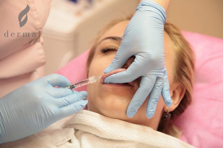 What you Need to Know before Getting Dermal Fillers