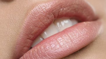 Inyecciones en los labios: antes y después y lo que debemos esperar