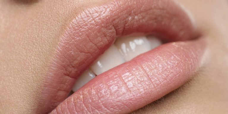 Lip Injections: Before and After and What We Should Expect