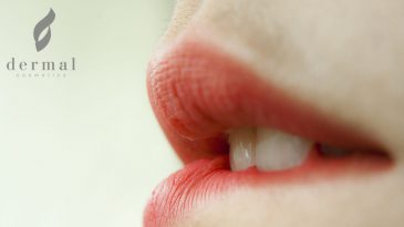 Les injections pour les lèvres font-elles mal ?